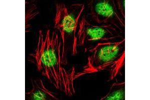 Immunofluorescence analysis of Hela cells using ZBTB16 mouse mAb (green). (ZBTB16 antibody)