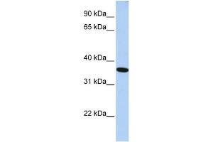 WB Suggested Anti-GTF2A1 Antibody Titration: 0. (GTF2A1 antibody  (N-Term))