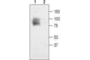 Western blot analysis of rat brain membranes: - 1. (CLCN3 antibody  (C-Term, Intracellular))