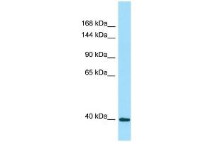 WB Suggested Anti-DRP2 Antibody Titration: 1. (DRP2 antibody  (Middle Region))