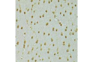 Immunohistochemistry of paraffin-embedded rat brain using RCC1 antibody (ABIN5973761) at dilution of 1/100 (40x lens). (RCC1 antibody)
