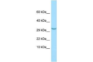 WB Suggested Anti-C1QTNF3 Antibody Titration: 1. (C1QTNF3 antibody  (N-Term))