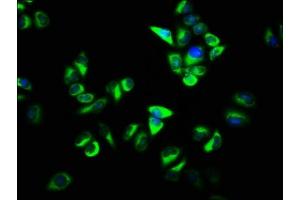 Immunofluorescence staining of Hela cells with ABIN7162395 at 1:133, counter-stained with DAPI. (OSBP antibody  (AA 628-802))