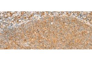 Immunohistochemistry of paraffin-embedded Human tonsil tissue using PPOX Polyclonal Antibody at dilution of 1:30(x200) (PPOX antibody)