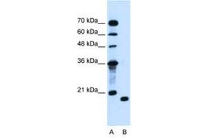 Image no. 1 for anti-Peptidyl-tRNA Hydrolase 2 (PTRH2) (AA 100-149) antibody (ABIN205058) (PTRH2 antibody  (AA 100-149))