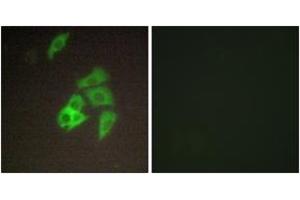 Immunofluorescence analysis of A549 cells, using ST14 Antibody. (ST14 antibody  (AA 10-59))