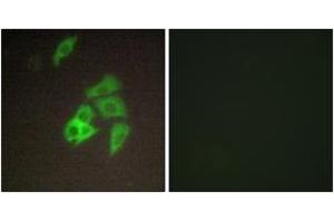Immunofluorescence analysis of A549 cells, using ST14 Antibody.