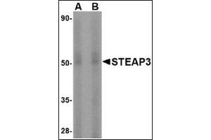Western blot analysis of STEAP3 in rat liver tissue lysate with this product at (A) 1 and (B) 2 μg/ml. (STEAP3 antibody  (N-Term))