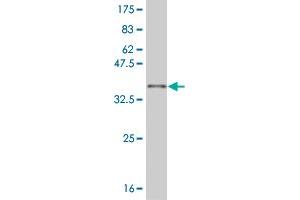 Western Blotting (WB) image for anti-Sine Oculis-Related Homeobox 3 (SIX3) (AA 273-332) antibody (ABIN520204)