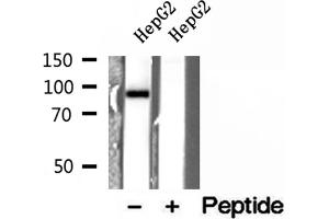 Western blot analysis of extracts of HepG2 cells, using ELAC2 antibody.