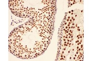 IHC-P testing of rat testis tissue (BRCA1 antibody  (AA 1661-1863))
