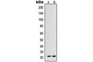 Western blot analysis of VEGFB expression in HT1080 (A), ACHN (B) whole cell lysates. (VEGFB antibody  (Center))