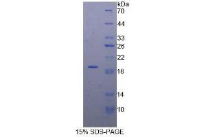 SDS-PAGE (SDS) image for Dishevelled Segment Polarity Protein 1 (DVL1) (AA 150-285) protein (His tag) (ABIN2124643)