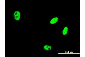 Immunofluorescence of monoclonal antibody to EHMT1 on HeLa cell. (EHMT1 antibody  (AA 1-100))