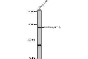Western blot analysis of extracts of Mouse brain, using SUPT16H (SPT16) antibody (ABIN7267097) at 1:1000 dilution. (SUPT16H antibody)
