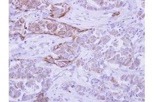 Image no. 1 for anti-WD Repeat Domain 49 (WDR49) (AA 343-666) antibody (ABIN1501751) (WDR49 antibody  (AA 343-666))