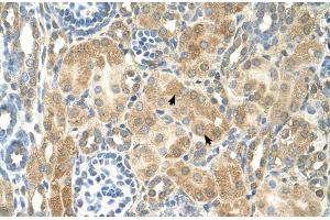 Immunohistochemistry (IHC) image for anti-Nuclear Receptor Subfamily 2, Group F, Member 2 (NR2F2) (N-Term) antibody (ABIN2781130)