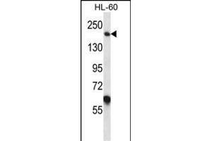 MYOM1 Antibody (Center) (ABIN657367 and ABIN2846414) western blot analysis in HL-60 cell line lysates (35 μg/lane).