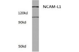 Western blot (WB) analysis of CD171 / L1CAM Antibody at 1/500 dilution in extracts from Raw264. (L1CAM antibody)