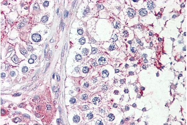 HRASLS antibody  (N-Term)