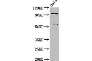 Adam23 antibody  (AA 498-647)