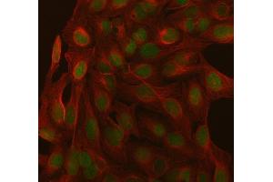 IF analysis of SAGE1 using anti-SAGE1 antibody (ABIN7602679) and anti-Beta Tubulin antibody (ABIN7602743). (SAGE1 antibody  (AA 94-633))