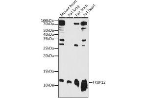 Western blot analysis of extracts of various cell lines, using FKBP12 antibody (ABIN3022503, ABIN3022504, ABIN3022505 and ABIN6218864) at 1:1000 dilution.