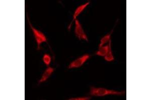 Immunofluorescence (fixed cells) (IF/ICC) image for anti-Heat Shock Protein 90kDa alpha (Cytosolic), Class A Member 1 (HSP90AA1) (C-Term) antibody (ABIN6262402)