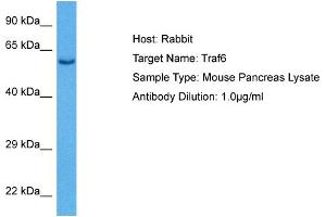 Host: Rabbit Target Name: TRAF6 Sample Tissue: Mouse Pancreas Antibody Dilution: 1ug/ml (TRAF6 antibody  (C-Term))