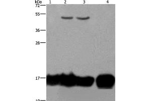 Western Blot analysis of A549 and K562 cell, Raji cell and Human fetal intestine tissue using IL17C Polyclonal Antibody at dilution of 1:250 (IL17C antibody)