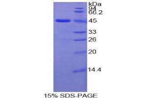SDS-PAGE analysis of Human MMP10 Protein. (MMP10 Protein)