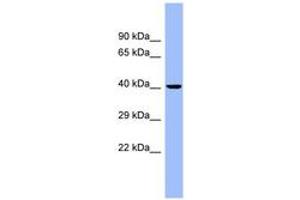 Image no. 1 for anti-Carcinoembryonic Antigen-Related Cell Adhesion Molecule 6 (CEACAM6) (AA 35-84) antibody (ABIN6741739) (CEACAM6 antibody  (AA 35-84))