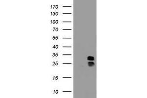 Image no. 2 for anti-Palmitoyl-Protein Thioesterase 1 (PPT1) (AA 100-306) antibody (ABIN1490801) (PPT1 antibody  (AA 100-306))