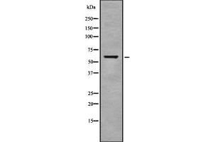 Western blot analysis of Cytochrome c Oxidase 1 using COLO205 whole cell lysates (COX1 antibody  (C-Term))
