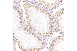 Immunohistochemistry analysis of paraffin-embedded mouse testis using,TTC12 (ABIN7075869) at dilution of 1: 4400 (TTC12 antibody)
