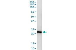 Immunoprecipitation of MAD2L2 transfected lysate using anti-MAD2L2 MaxPab rabbit polyclonal antibody and Protein A Magnetic Bead , and immunoblotted with MAD2L2 purified MaxPab mouse polyclonal antibody (B02P) . (MAD2L2 antibody  (AA 1-211))