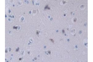 Immunohistochemistry (IHC) image for anti-Neuropilin 2 (NRP2) (AA 231-490) antibody (ABIN7435322)