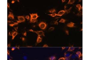 Immunofluorescence analysis of C6 cells using CSF2 Polyclonal Antibody at dilution of 1:100. (GM-CSF antibody)