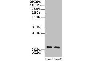 Western blot All lanes: UBE2I antibody at 2 μg/mL Lane 1: 293T whole cell lysate Lane 2: EC109 whole cell lysate Secondary Goat polyclonal to rabbit IgG at 1/15000 dilution Predicted band size: 19 kDa Observed band size: 19 kDa (UBE2I antibody  (AA 1-157))