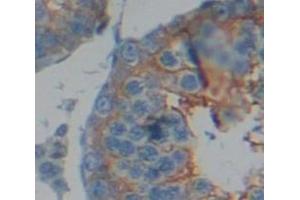 IHC-P analysis of Human Tissue, with DAB staining. (Dystrophin antibody  (AA 3048-3328))
