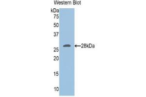 Western blot analysis of the recombinant protein. (UCHL3 antibody  (C-Term))