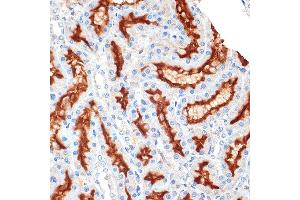 Immunohistochemistry of paraffin-embedded rat kidney using Syntaxin 3 Rabbit mAb (ABIN7270686) at dilution of 1:100 (40x lens). (STX3 antibody)