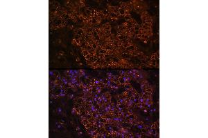Immunofluorescence (IF) image for anti-phosphoenolpyruvate Carboxykinase 1 (Soluble) (PCK1) (C-Term) antibody (ABIN3022754)