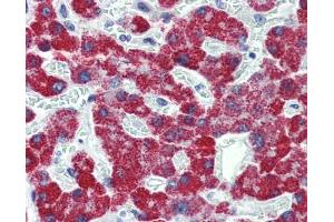 IHC-P Image Immunohistochemical analysis of paraffin-embedded human liver, using ACADS, antibody(10 μg/ml). (ACADS antibody  (N-Term))
