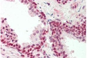 Human Prostate: Formalin-Fixed, Paraffin-Embedded (FFPE) (ZNF461 antibody  (AA 126-425))