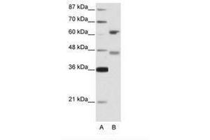 Image no. 1 for anti-Regulatory Factor X 4 (RFX4) (AA 352-401) antibody (ABIN203209) (RFX4 antibody  (AA 352-401))