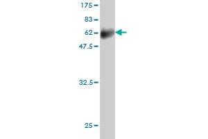 Western Blot detection against Immunogen (61. (FCER2 antibody  (AA 1-321))
