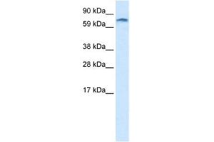 Human heart; WB Suggested Anti-ZNF84 Antibody Titration: 1. (ZNF84 antibody  (C-Term))