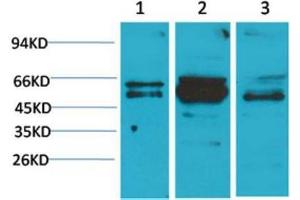 Western Blot (WB) analysis of 1) A431, 2)Mouse Brain Tissue, 3) Rat Brain Tissue with Flotllin-2 Rabbit Polyclonal Antibody diluted at 1:2000. (Flotillin 2 antibody)
