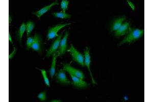 Immunofluorescence staining of Hela cells with ABIN7165873 at 1:133, counter-stained with DAPI. (NLRC5 antibody  (AA 95-208))